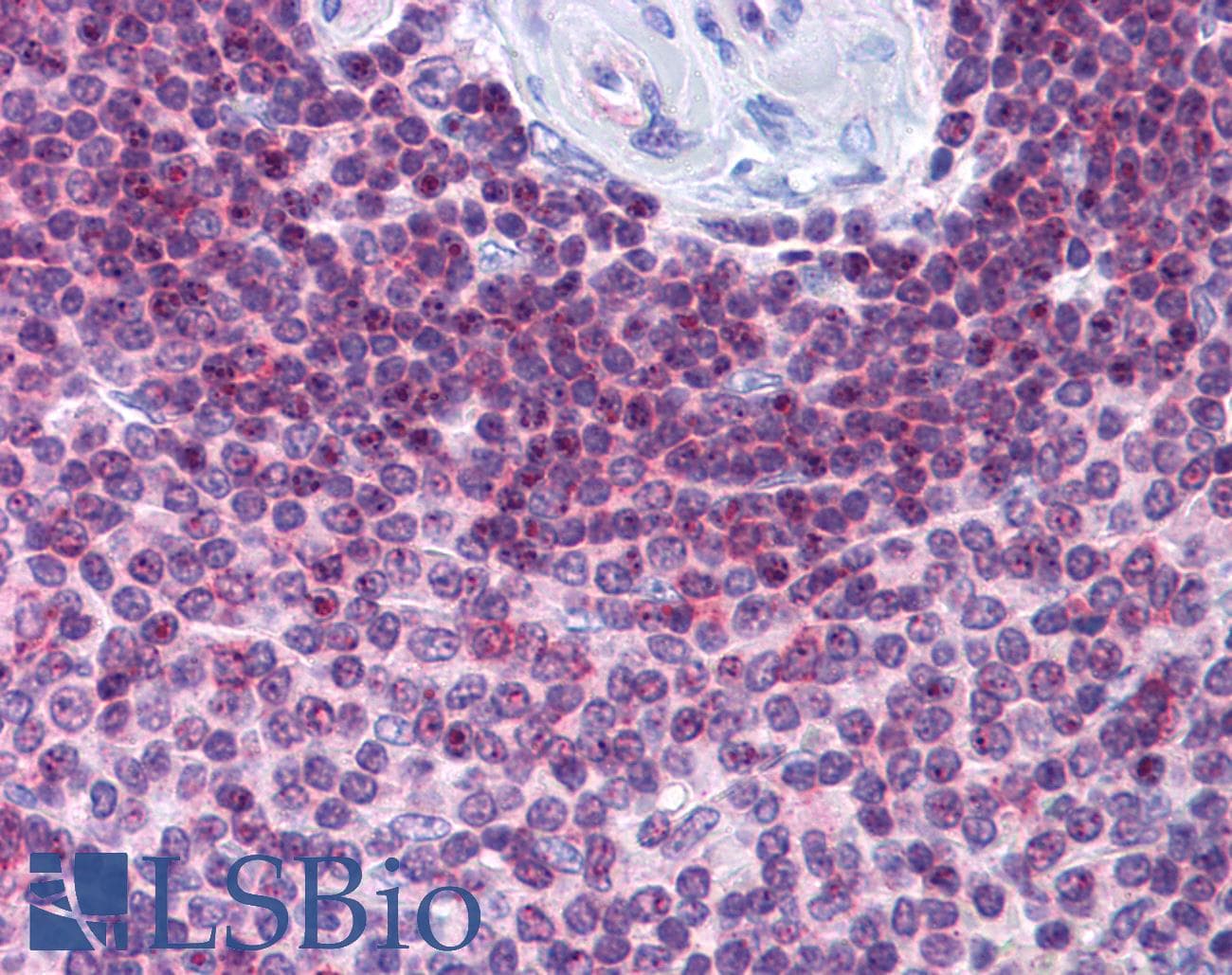 IHC-plus™ HVCN1 / HV1 Antibody