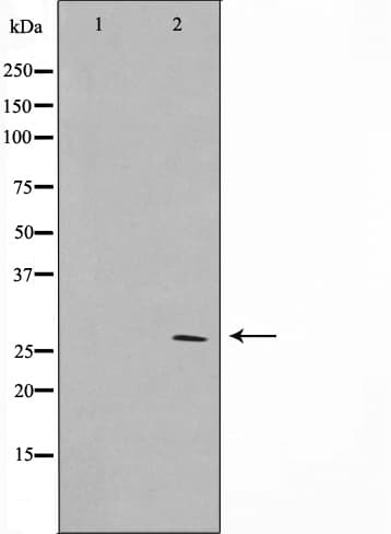 HOXD12 Antibody