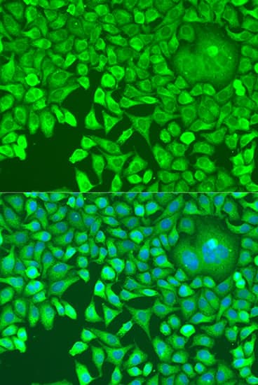 PUM1 Antibody