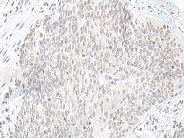 ORC1 Antibody