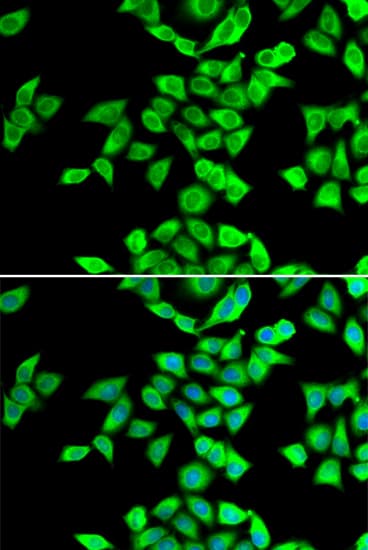 NMT2 Antibody