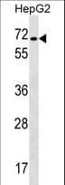 Polyclonal Rabbit anti-Human CACNB1 Antibody (aa543-572, WB)