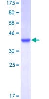 Human CSTB / Cystatin B / Stefin B Protein (Recombinant GST)