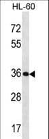 IHC-plus™ KLK9 / Kallikrein 9 Antibody (aa82-111)