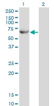 GK2 / Glycerol Kinase 2 Antibody (clone 3G4)