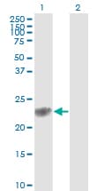 GSTP1 / GST Pi Antibody (clone 2G6-F6)