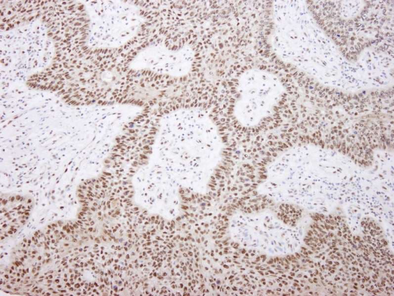 Polyclonal Rabbit anti-Human EFTUD2 Antibody (aa1-50, IHC)