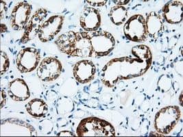 IGF2BP2 Antibody (clone OTI3F9)
