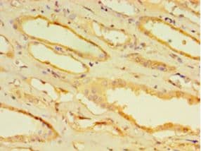 CPVL Antibody (aa23-476)