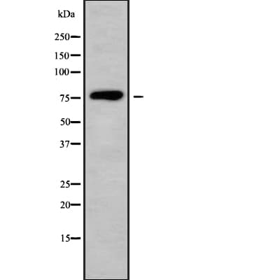 FBLN1 / Fibulin 1 Antibody