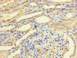 Polyclonal Rabbit anti-Human TGFB3 / TGF Beta3 Antibody