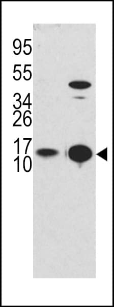 IHC-plus™ MAP1LC3B / LC3B Antibody (Thr6)