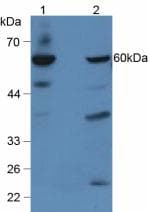 GBA / Glucosidase Beta Acid Antibody (aa334-498, APC)