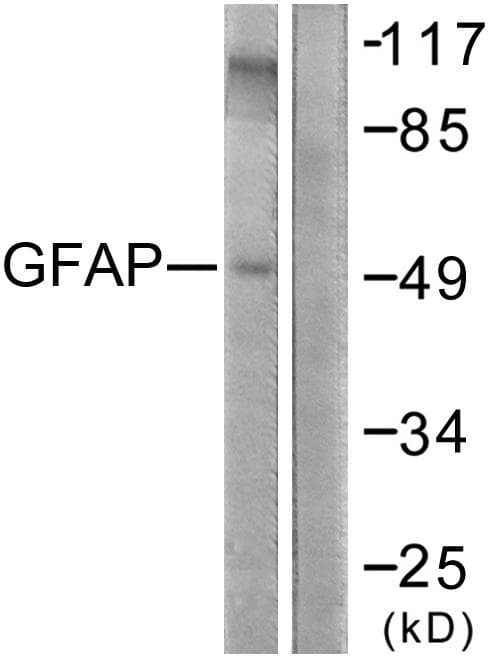 GFAP Antibody (p38)