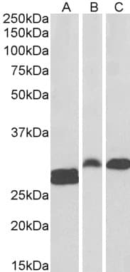 IHC-plus™ Polyclonal Goat anti-Human ANP32B Antibody (aa239-251, IHC, WB)