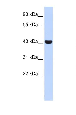 NR2E1 / TLX Antibody (N-Terminus)