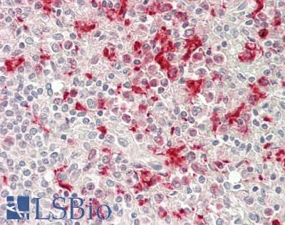 IHC-plus™ ITGA3 / CD49c Antibody (clone P1B5)