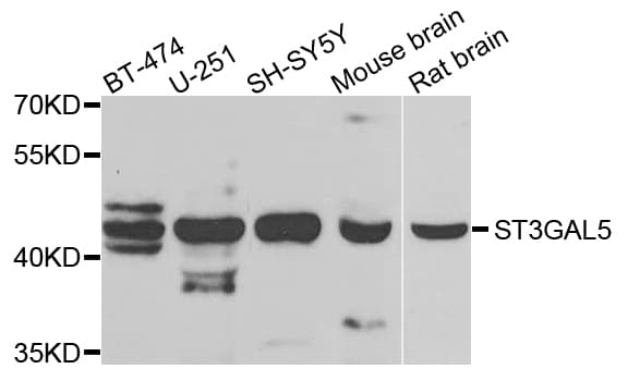 ST3GAL5 / GM3 Synthase Antibody