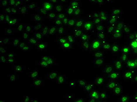 Polyclonal Rabbit anti-Human RSRC1 Antibody (IHC, IF, WB)