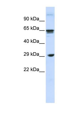 CLEC4M / L-SIGN / CD299 Antibody (N-Terminus)