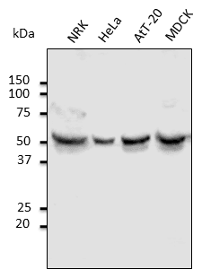 IHC-plus™ TUBA4A / TUBA1 Antibody (N-Terminus)