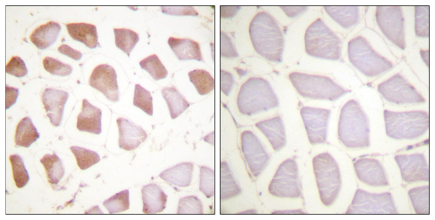 Polyclonal Rabbit anti-Human TNNI3 / Cardiac Troponin I Antibody (p142, IHC, WB)