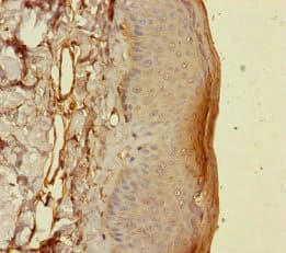 Polyclonal Rabbit anti-Human BCMP84 / S100A14 Antibody (IHC)