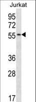 Complement C1RL Antibody (aa161-190)