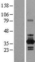 NEK6 Protein (Over-Expression Lysate Myc-DDK (Flag))