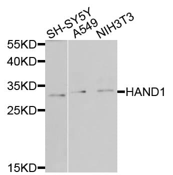 HAND1 Antibody