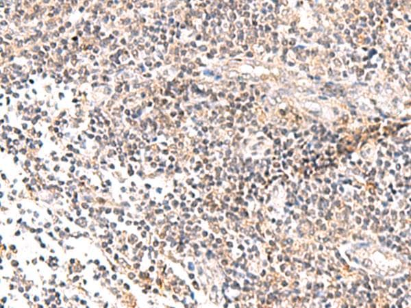 Polyclonal Rabbit anti-Human IL36B Antibody (IHC)