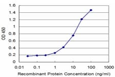 Esterase D / ESD Antibody (clone 1E1)