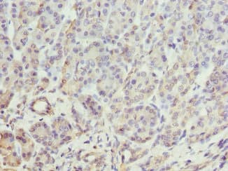 HSBLMHC1 / BTNL2 Antibody