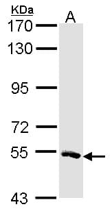 MSTO1 / MST Antibody (aa34-327)