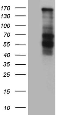 COL3A1 / Collagen III Antibody (aa981-1205, clone OTI2G3)