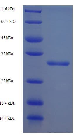 Human ST8SIA4 Protein (Recombinant His-SUMO)