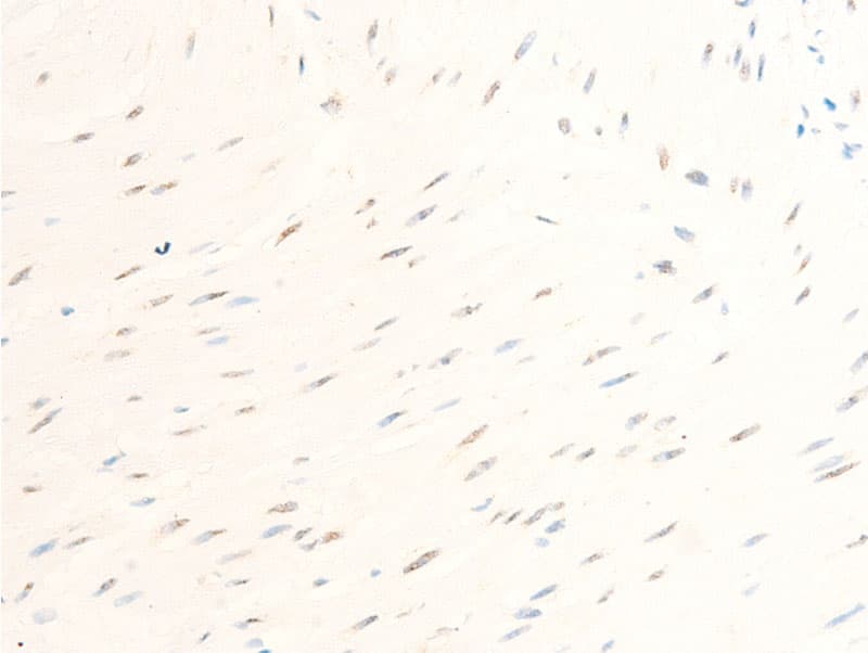 BIRC5 / Survivin Antibody (phospho-Thr117)