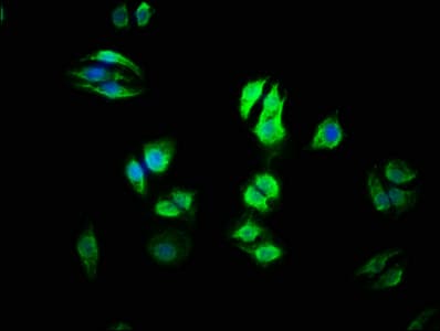Polyclonal Rabbit anti-Human URI1 / NNX3 Antibody (IHC, WB)