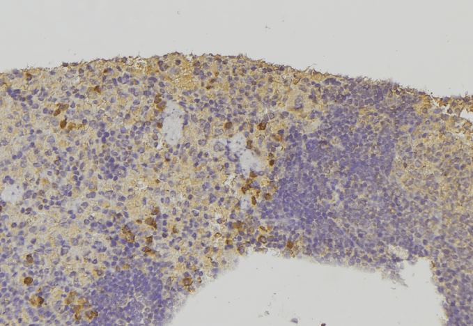 HSPA6 / HSP70B' Antibody