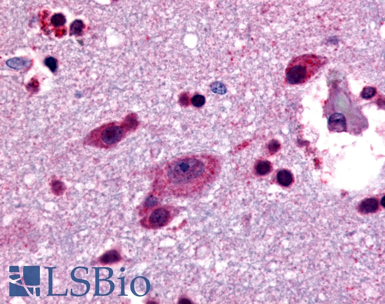 IHC-plus™ Polyclonal Rabbit anti-Human GPR48 / LGR4 Antibody (C-Terminus, IHC)