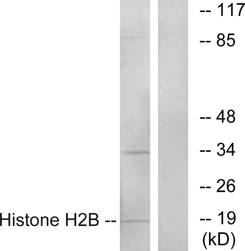 IHC-plus™ Polyclonal Rabbit anti-Human Histone H2B Antibody (aa1-50, IHC, IF, WB)