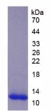 Rat TGFB2 / TGF Beta2 Protein (Recombinant His)