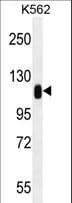 TRIM28 / KAP1 Antibody (aa178-207)