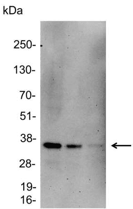 GST / Glutathione S-Transferase Antibody