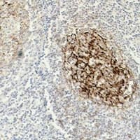 FCER2 / CD23 Antibody