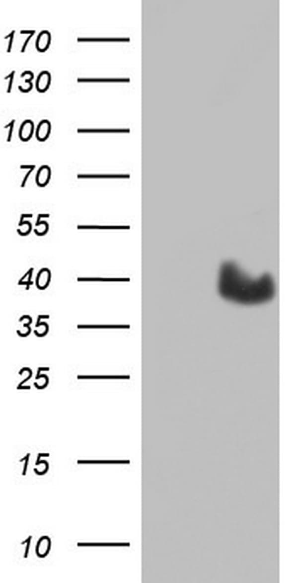 MYF5 / MYF 5 Antibody (clone OTI2G5)