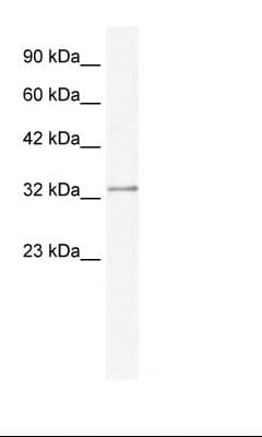 Polyclonal Rabbit anti-Human NUDT9 Antibody (C-Terminus, IHC, WB)