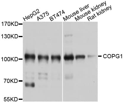 COPG / Gamma-COP Antibody