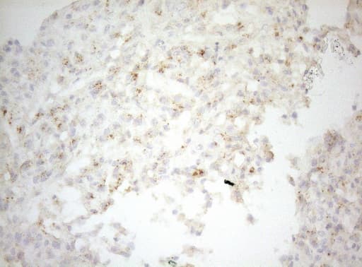Monoclonal Mouse anti-Human CPM / Carboxypeptidase M Antibody (clone OTI2D11, aa124-423, IHC, WB)