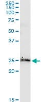 BCL2L2 / Bcl-w Antibody (clone 2E4)